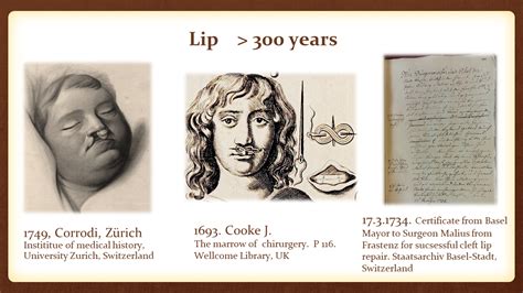 History Of Cleft Lip And Palate Treatment Research Group Mueller Aa