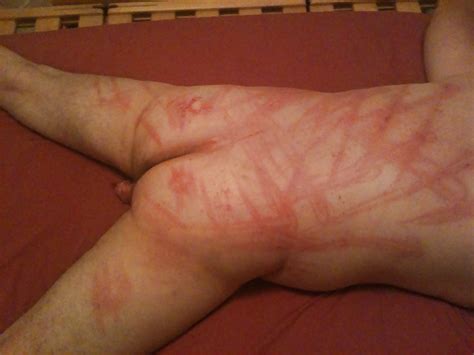 Flogging Caning Marks From Mistress Bondage Porn Pictures Xxx Photos
