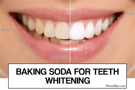 How To Whiten Your Teeth With Baking Soda 7 Best Ways
