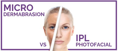 microdermabrasion vs ipl photofacial what s the difference eureka body care and spa