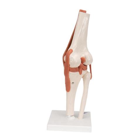 FMOGE Knee Joint Model Human Body Anatomy Replica Set Of 4 Stage