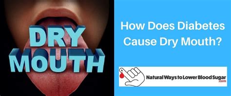 How Does Diabetes Cause Dry Mouth 21 Tips To Prevent