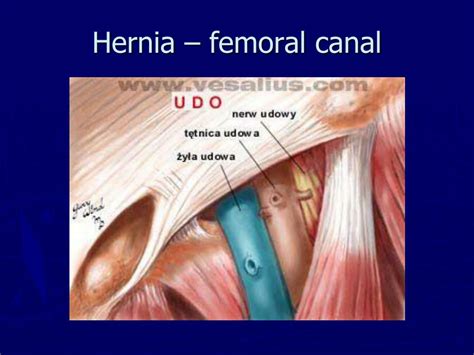 Femoral Hernia Anatomy