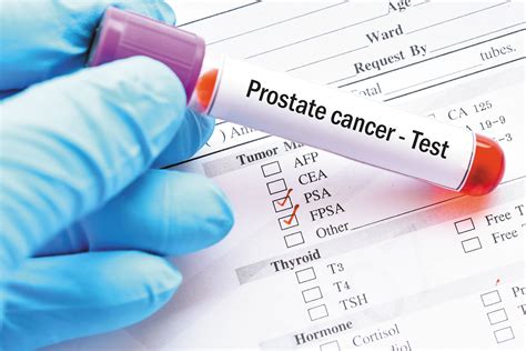 Task Force Takes Positive Step With New Prostate Cancer Testing Sexiz Pix