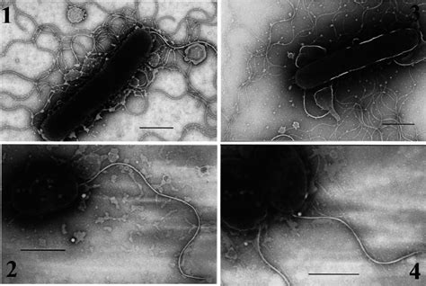 Transmission Electron Microscopy Images Of Wild Type And Mutant