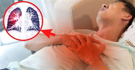 Embolia pulmonar síntomas que podrían indicar que estás en peligro Salud