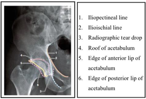 Surgical Anatomy Of Acetabulum And Biomechanics Intechopen