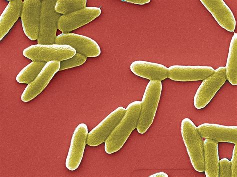 Uncovering Antibiotic Resistance In Pseudomonas Aeruginosa Medical