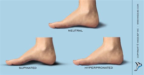 In this video we go over the three main arches of the foot, medial arch, lateral arch, and transverse arch. Understanding the Medial Arch Height - MASS4D® Foot Orthotics