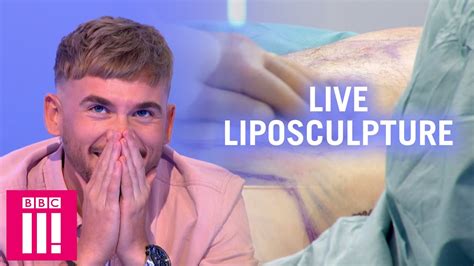 Watching A Live Liposculpture Procedure Would You Have It Done Plastic Surgery Undressed