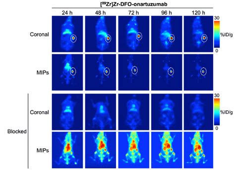 89 Zr Labeled Onartuzumab Pet Imaging In A Met Overexpressing Pdx Rcc