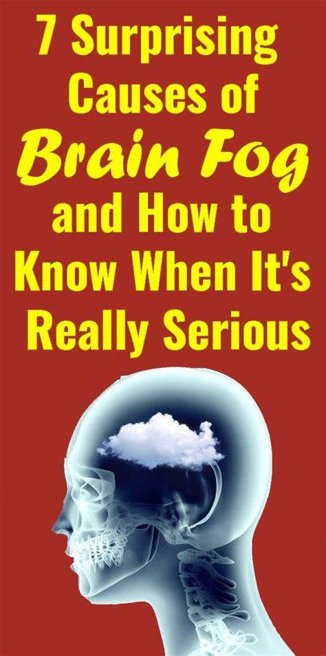 7 Causes Of Brain Fog That Will Surprise You Brain Fog Medical