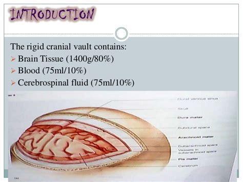 What You Should Know About Intracranial Pressure