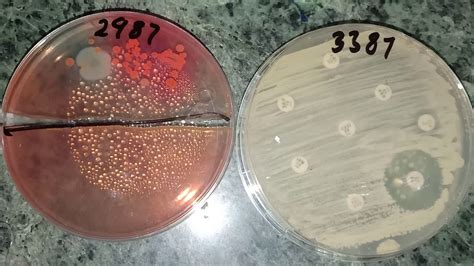 Its Urine At Cled Agar Identify Ak Is Sensitive Youtube