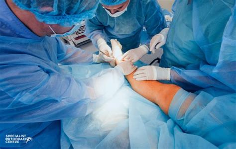 Bunion Surgery Singapore Orthopaedic Surgeries Soc