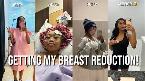 Getting Breast Reduction Surgery Vlog Pre Op Surgery Post Op Etc
