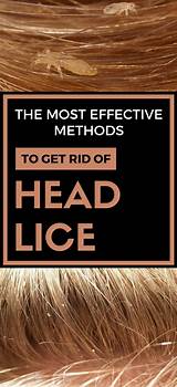 Images of What Is The Most Effective Lice Treatment