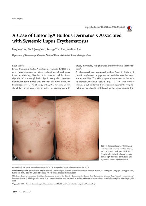 Pdf A Case Of Linear Iga Bullous Dermatosis Associated With Systemic