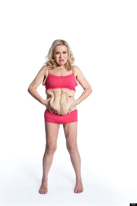 Tina Malone To Undergo Surgery To Remove 12lbs Of Excess Skin And It