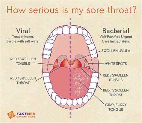 Can Allergies Cause Sore Throat And Ear Pain