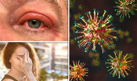 Covid 19 Symptoms From A ‘fizzing Sensation To ‘swollen Eyelids