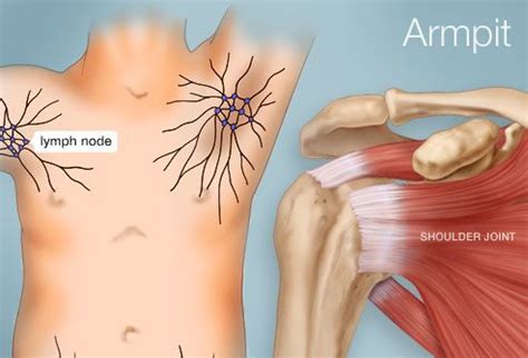 There Are More Than Lymph Nodes Small Lumps Of Tissue That Are Part Of The Body S Lymphatic