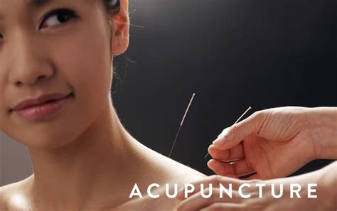 Acupuncture With Our Registered Acupuncturist Toronto Physiotherapy