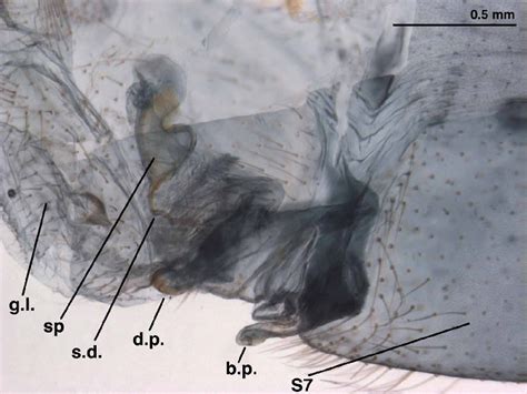 Leucochrysa L Boxi Spermathecal Complex And Subgenitale Lateral