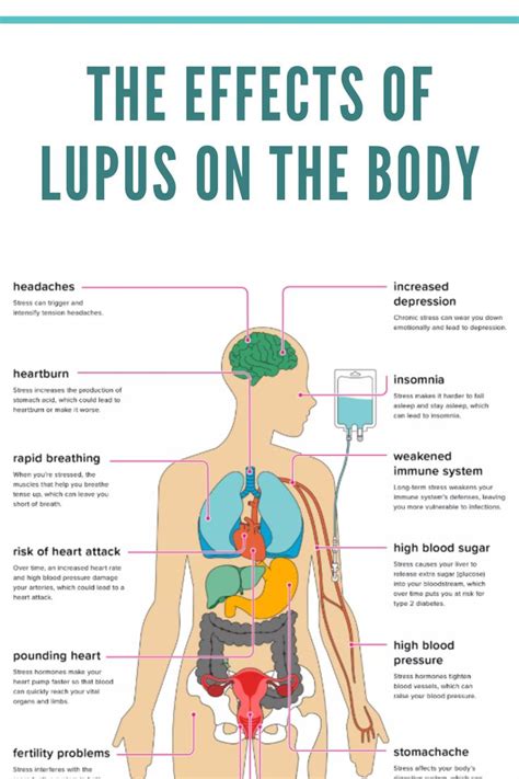 The Effects Of Lupus On The Body Schoen Med Lupus Facts Lupus