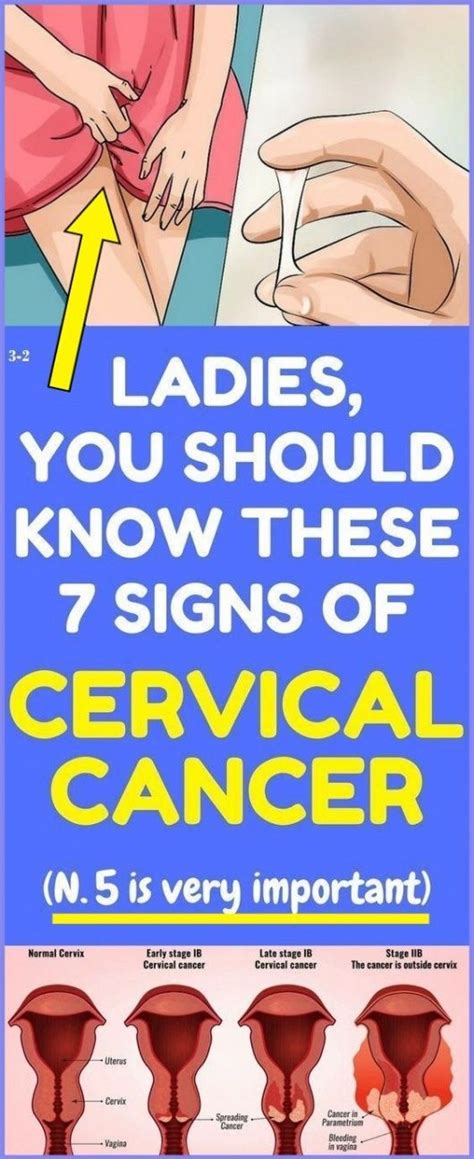 Hpv is a common virus that is passed from one person to another during sex. 7 Warning Symptoms of Cervical Cancer That Every Women ...