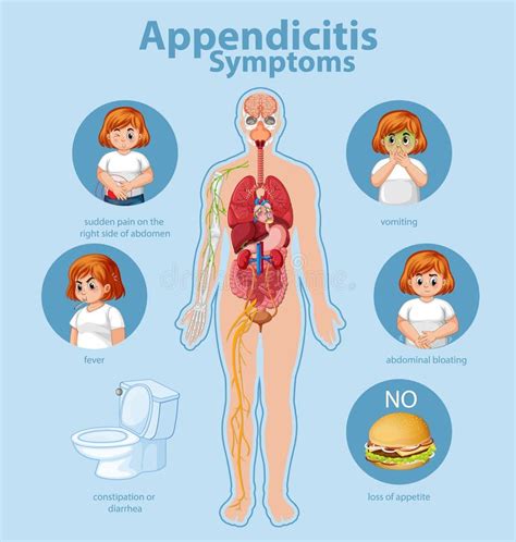 รายการ 92 ภาพ Appendix ทางการแพทย์ ความละเอียด 2k 4k