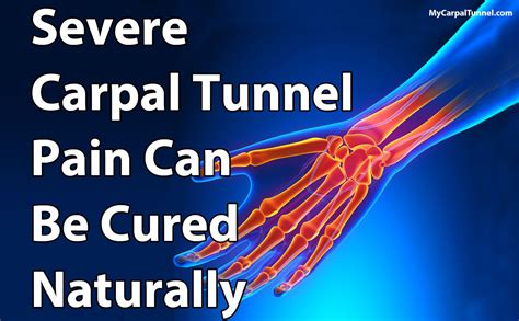 Carpal Tunnel Pain Ladegset