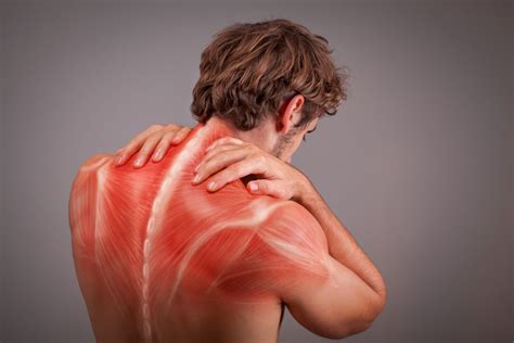 Myofascial Pain Syndrome Causes Symptoms And Treatments