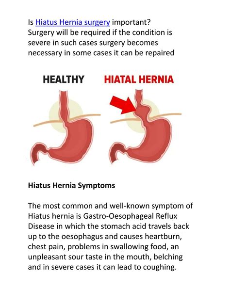 Ppt Hiatus Hernia Explained And A Possible Way Cure Powerpoint Presentation Id11505669