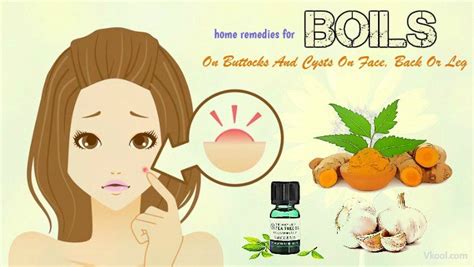 Home Remedies For Boils And Cysts On Face Back Or Leg