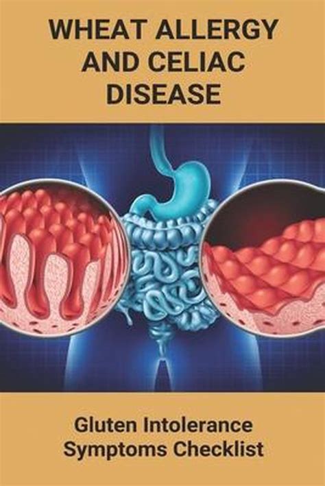 Wheat Allergy And Celiac Disease Lan Arties 9798740674841 Boeken