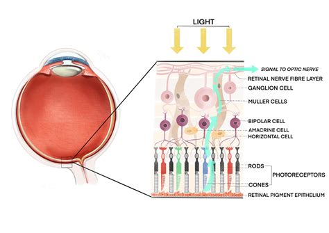 Leber Congenital Amaurosis (LCA): for patients - Gene Vision