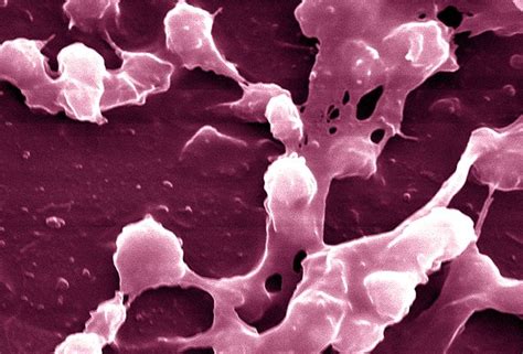 Antibiotics May Make Superbug Mrsa Stronger Huffpost Impact