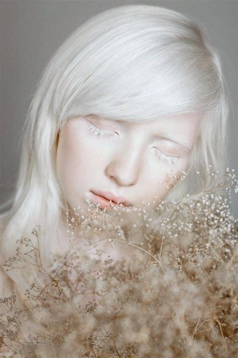 Nastya Kiki Zhidkova Albino Girl Albino Model Pale Beauty