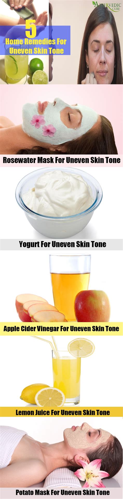 Amazing Home Remedies For Uneven Skin Tone Natural Treatments For