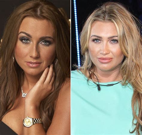 Lauren Goodger Plastic Surgery Before And After Photos Plastic