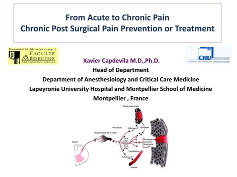 Ppt From Acute To Chronic Pain Chronic Post Surgical Pain Prevention