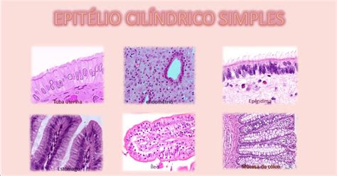 Histologia And Embriologia Para Fisioterapia Epitélio Cilíndrico Simples