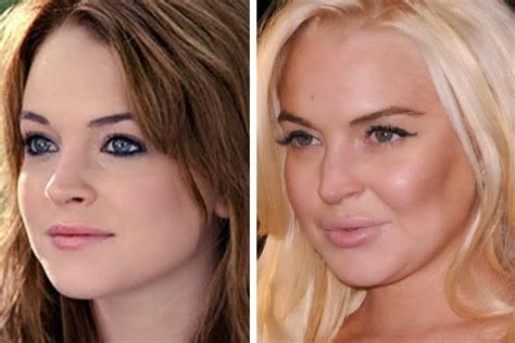 Lindsay Lohan Destroyed By Plastic Surgery Nose Job Breast Implants