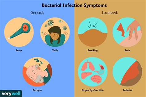 Een Overzicht Van Bacteriële Infecties Med Nl