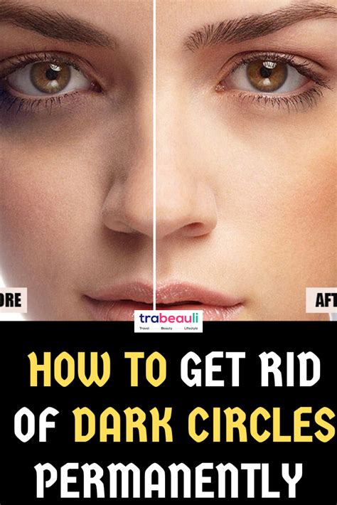 Dark Eyes Circles Remedies Eye Circle Remedies Dark Circles Around
