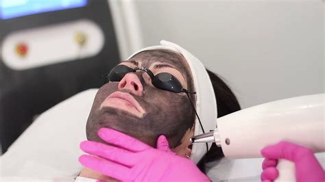 Best Facial Treatment Carbon Laser Facial Youtube