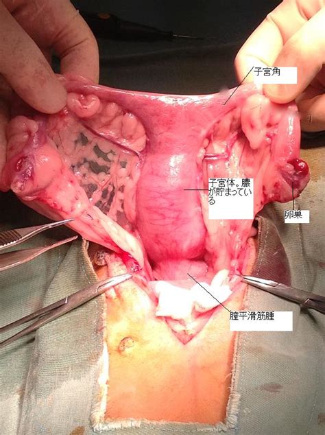 女性器解剖全裸投稿画像606枚 中国女性全裸死体検死解剖