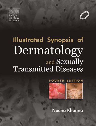 illustrated synopsis of dermatology and sexually transmitted diseases e book english edition