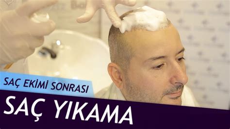 saç ekimi sonrası saç nasıl yıkanır ilk 14 gün youtube